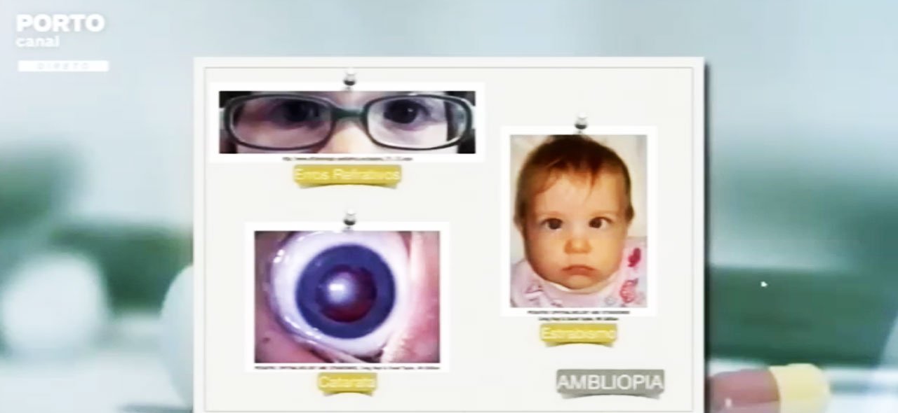 Oftalmologia-pediatrica-estrabismo_porto-canal-parte2_1280x590 Oftalmologia pediatrica estrabismo - porto canal parte 2