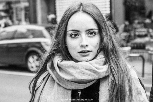 Estrabismo nos Adultos